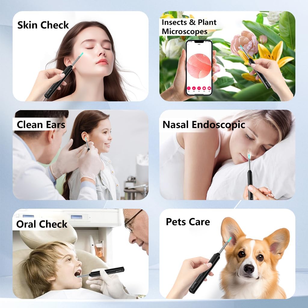 Smart Ear Cleaner with HD Camera – Wireless Otoscope for Android & iPhone Martika Trendy Finds