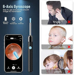 Smart Ear Cleaner with HD Camera – Wireless Otoscope for Android & iPhone Martika Trendy Finds